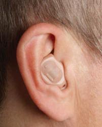 ITE Hearing Aids may be appropriate for severe hearing loss.